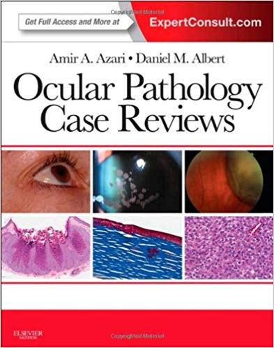 (eBook PDF)Ocular Pathology Case Reviews by Amir A. Azari MD , Daniel M. Albert MD MS