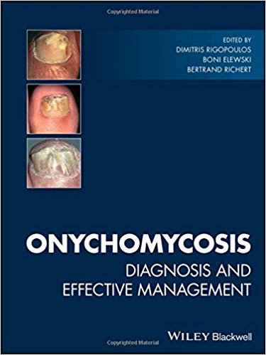 (eBook PDF)Onychomycosis: Diagnosis and Effective Management by Dimitris Rigopoulos , Boni Elewski , Bertrand Richert