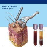 (eBook PDF)PRP and Microneedling in Aesthetic Medicine PDF+VIDEOS by Amelia K. Hausauer