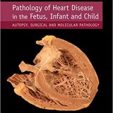 (eBook PDF)Pathology of Heart Disease in the Fetus, Infant and Child by Michael T. Ashworth