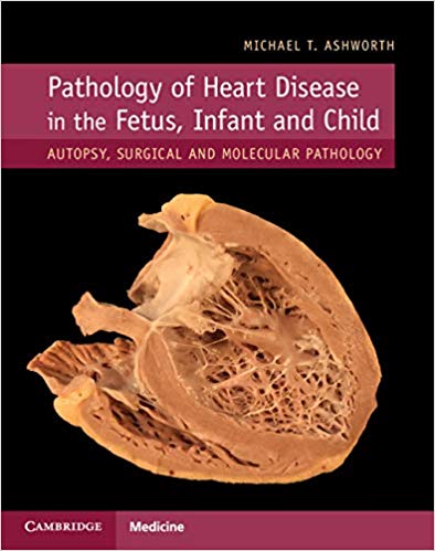 (eBook PDF)Pathology of Heart Disease in the Fetus, Infant and Child by Michael T. Ashworth