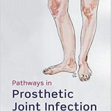 (eBook PDF)Pathways in Prosthetic Joint Infection by Umraz Khan , Graeme Perks , Rhidian Morgan-Jones , Peter James , Colin Esler , Vince Smyth , Vanya Gant