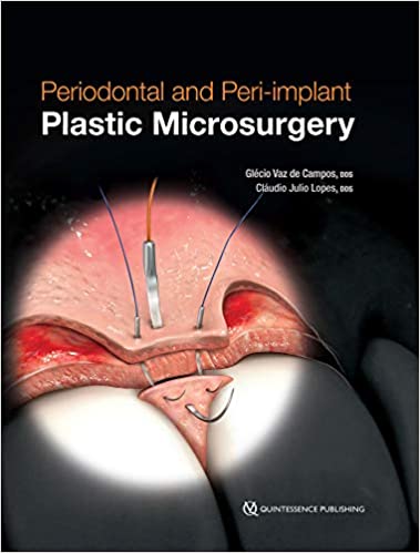 (eBook PDF)Periodontal and Peri-implant Plastic Microsurgery by Glécio Vaz de Campos , Cláudio Julio Lopes