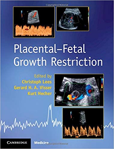 (eBook PDF)Placental-Fetal Growth Restriction by Christoph Lees , Gerard H. A. Visser , Kurt Hecher