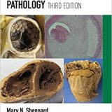 (eBook PDF)Practical Cardiovascular Pathology 3rd Edition  by Mary N. Sheppard