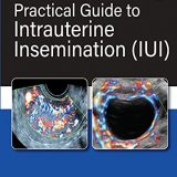 (eBook PDF)Practical Guide To Intrauterine Insemination (IUI) by Chaitanya Nagori , Sonal Panchal