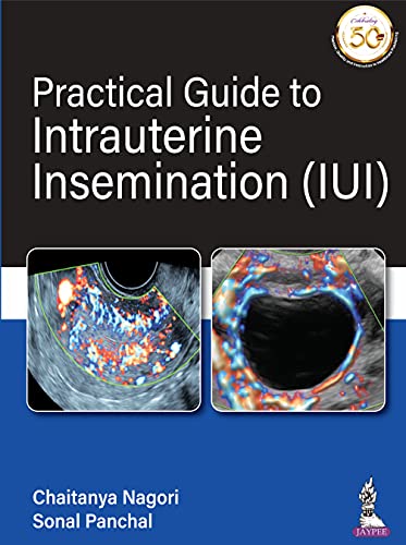 (eBook PDF)Practical Guide To Intrauterine Insemination (IUI) by Chaitanya Nagori , Sonal Panchal