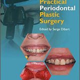 (eBook PDF)Practical Periodontal Plastic Surgery 2nd Edition by Serge Dibart