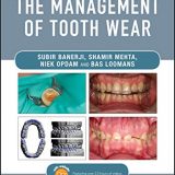 (eBook PDF)Practical Procedures in the Management of Tooth Wear by Subir Banerji , Shamir B. Mehta , Niek Opdam , Bas Loomans