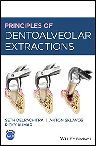 (eBook PDF)Principles of Dentoalveolar Extractions
