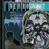 (eBook PDF)Procedural Manual of Neurosonology by Jose C. Navarro, Vijay K. Sharma