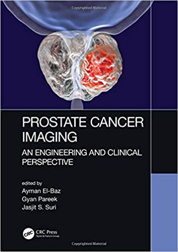 (eBook PDF)Prostate Cancer Imaging by Ayman El-Baz , Gyan Pareek , Jasjit S. Suri