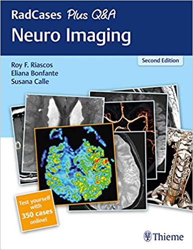 (eBook PDF)RadCases Plus Q and A Neuro Imaging 2nd Edition by Roy Riascos , Eliana Bonfante , Susana Calle