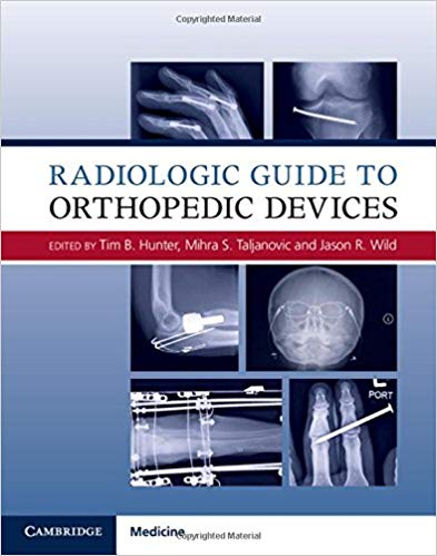 (eBook PDF)Radiologic Guide to Orthopedic Devices by Tim B. Hunter , Mihra S. Taljanovic , Jason R. Wild