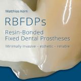 (eBook PDF)Resin-Bonded Fixed Dental Prostheses: Minimally invasive - esthetic - reliable 1st Edition by Matthias Kern