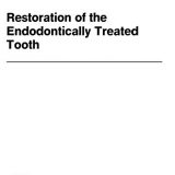 (eBook PDF)Restoration of the Endodontically Treated Tooth by Herbert T. Jr Shillingburg , James C. Kessler