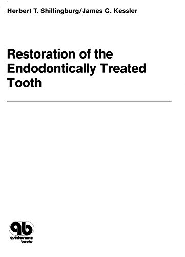 (eBook PDF)Restoration of the Endodontically Treated Tooth by Herbert T. Jr Shillingburg , James C. Kessler