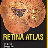 (eBook PDF)Retina Atlas  by Manpreet Grewal,SPS: Brar,Mansi Sharm,Mangat Ram Dogra,Dilraj S Grewal