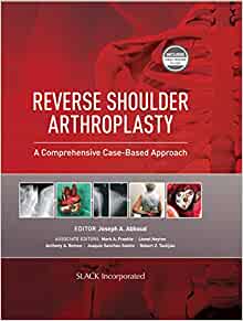(eBook PDF)Reverse Shoulder Arthroplasty A Comprehensive Case-Based Approach by Joseph A Abboud MD , Joseph A. Abboud , Mark A. Frankle , Lionel Neyton