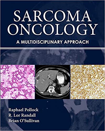 (eBook PDF)Sarcoma Oncology A Multidisciplinary Approach by Raphael Pollock , R. Lor Randall , Brian O'Sullivan , Raphael E. Pollock