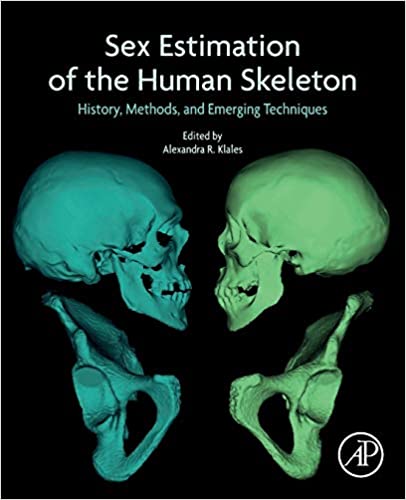 (eBook PDF)Sex Estimation of the Human Skeleton by Alexandra R. Klales PhD