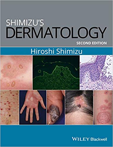 (eBook PDF)Shimizu s Dermatology, 2nd Edition by Hiroshi Shimizu
