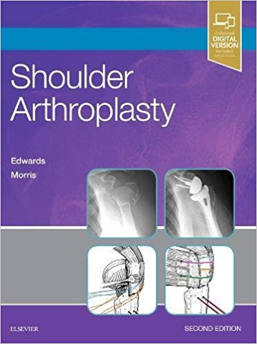(eBook PDF)Shoulder Arthroplasty, 2e 2nd Edition by T. Bradley Edwards MD , Brent J. Morris MD