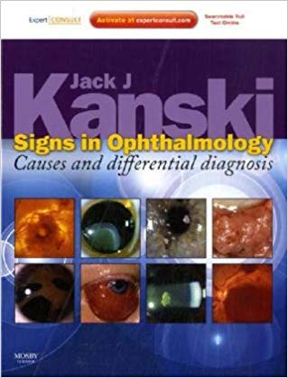 (eBook PDF)Signs in Ophthalmology - Causes and differential diagnosis by Jack J. Kanski MD MS FRCS FRCOphth