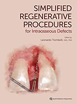 (eBook PDF)Simplified Regenerative Procedures for Intraosseous Defects by Leonardo Trombelli