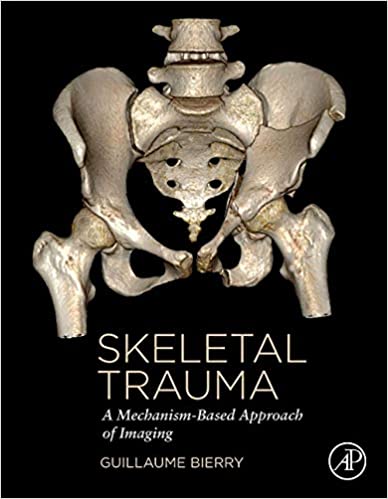 (eBook PDF)Skeletal Trauma A Mechanism-Based Approach of Imaging by Guillaume BIERRY