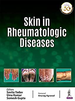 (eBook PDF)Skin In Rheumatologic Diseases 1st edition by Savita Yadav