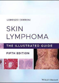(eBook PDF)Skin Lymphoma: The Illustrated Guide 5th Edition by Lorenzo Cerroni