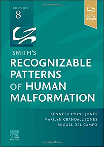 (eBook PDF)Smith's Recognizable Patterns of Human Malformation - E-Book 8e by Kenneth Lyons Jones MD , Marilyn Crandall Jones MD , Miguel del Campo MD PhD