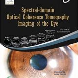 (eBook PDF)Spectral-domain Optical Coherence Tomography Imaging of the Eye by Anand Vinekar