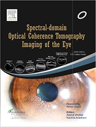 (eBook PDF)Spectral-domain Optical Coherence Tomography Imaging of the Eye by Anand Vinekar