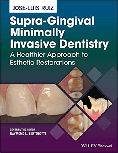 (eBook PDF)Supra-Gingival Minimally Invasive Dentistry by Jose-Luis Ruiz