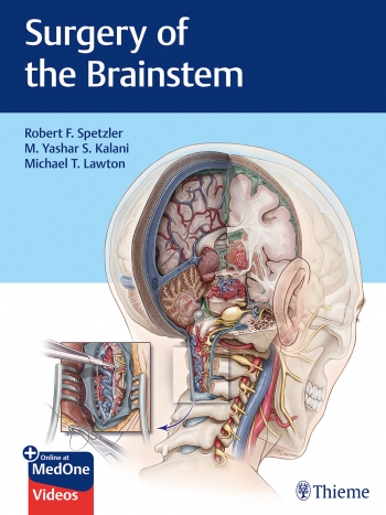 (eBook PDF)Surgery of the Brainstem by Robert F. Spetzler , M. Yashar S. Kalani , Michael Lawton