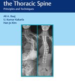 (eBook PDF)Surgery of the Thoracic Spine: Principles and Techniques by Ali Baaj , U. Kumar Kakarla , Han Jo Kim