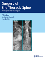 (eBook PDF)Surgery of the Thoracic Spine: Principles and Techniques by Ali Baaj , U. Kumar Kakarla , Han Jo Kim