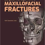 (eBook PDF)Surgical Management of Maxillofacial Fractures by Yoh Sawatari