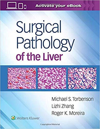(eBook PDF)Surgical Pathology of the Liver +EPUB版 by Michael Torbenson MD , Roger Moreira MD , Lizhi Zhang MD