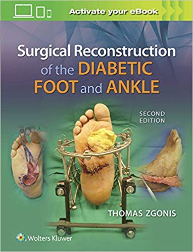 (eBook PDF)Surgical Reconstruction of the Diabetic Foot and Ankle 2nd Edition by Thomas Zgonis DPM FACFAS
