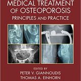 (eBook PDF)Surgical and Medical Treatment of Osteoporosis: Principles and Practice by Peter V. Giannoudis, Thomas A. Einhorn
