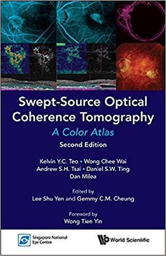 (eBook PDF)Swept-Source Optical Coherence Tomography:A Color Atlas 2nd Edition by Kelvin Y C Teo , Chee Wai Wong , Andrew S H Tsai , Daniel S W Ting , Dan MileaShu Yen LeeGemmy C M CheungTien Yin Wong