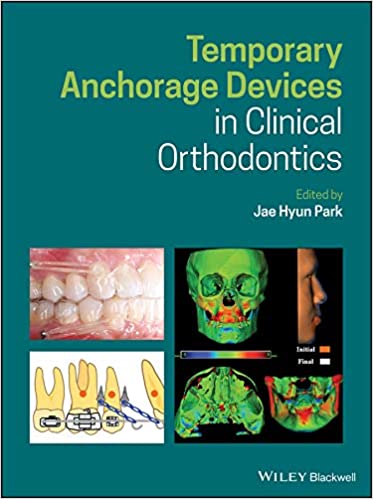 (eBook PDF)Temporary Anchorage Devices in Clinical Orthodontics 1st Edition by Jae Hyun Park