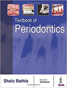(eBook PDF)Textbook of Periodontics by Shalu Bathla , S. G. Damle (Foreword)
