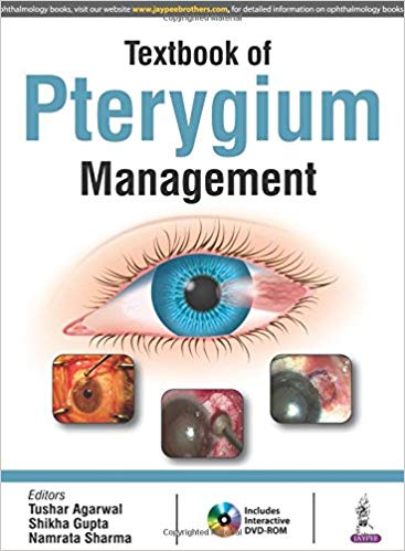 (eBook PDF)Textbook of Pterygium Management by Tushar Agarwal , Shikha Gupta , Namrata Sharma