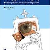 (eBook PDF)The Art of Pterygium Surgery PDF+21 VIDEOS by Arun C. Gulani