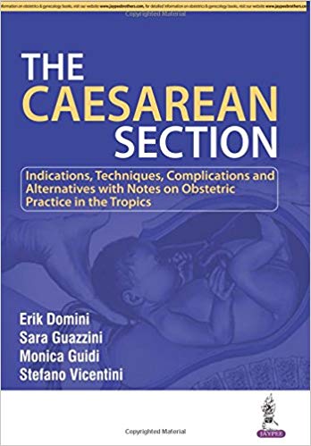 (eBook PDF)The Caesarean Section by Erik, M.D. Domini , Sara, M.D. Guazzini , Monica, M.D. Guidi , Stefano, M.D. Vicentini