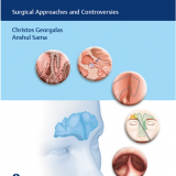 (eBook PDF)The Frontal Sinus Surgical Approaches and Controversies by Christos Georgalas , Anshul Sama